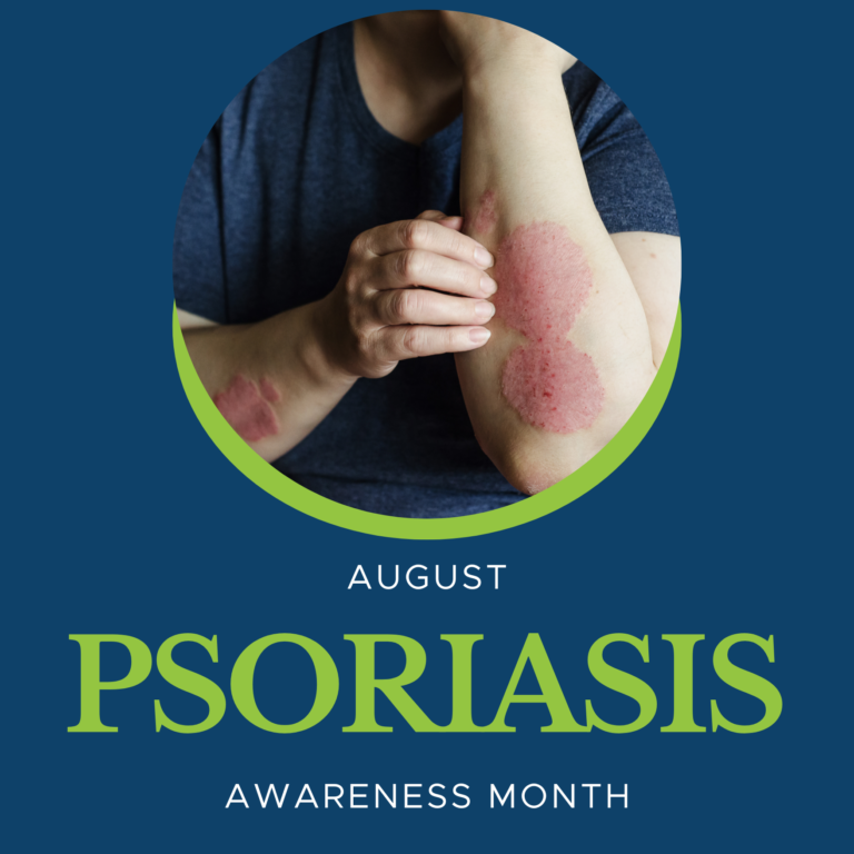 The Impact of Psoriasis and the Need for Awareness